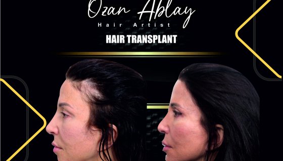 Müşterimiz ( İsmi Açıklanmayan )